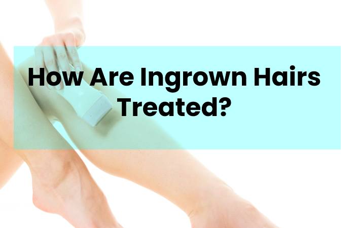 How Are Ingrown Hairs Treated?