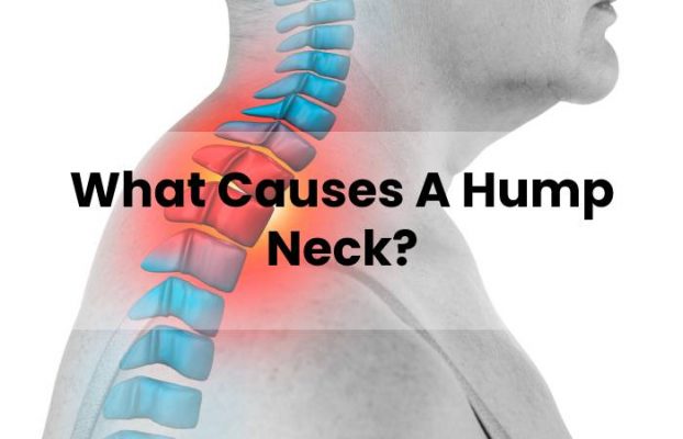 How To Fix Hump Neck - What Causes Does It Has?