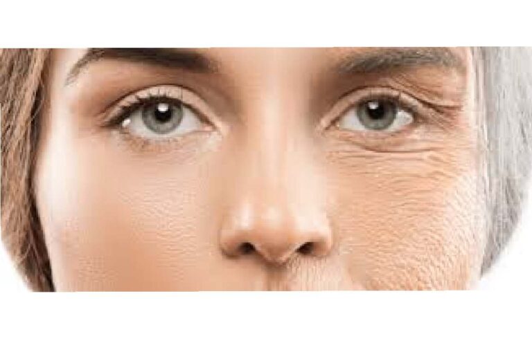 Erase Wrinkles and Fine Lines_